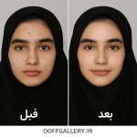 ژل شستشوی عمیق صورت مدل Deep Clean مناسب انواع پوست حجم 200 میل نوتروژینا